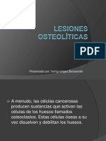 Lesiones Osteolíticas