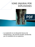 Sindrome por explosiones