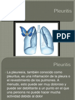 Pleuritis