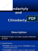 Syndactyly and Clinodactyly