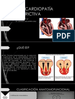 MIOCARDIOPATÍA RESTRICTIVA COMPLETA