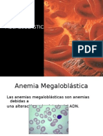 Anemia Megaloblastica