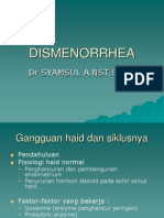 K48 - Dismenorrhea