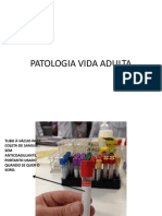 Patologia Vida Adulta