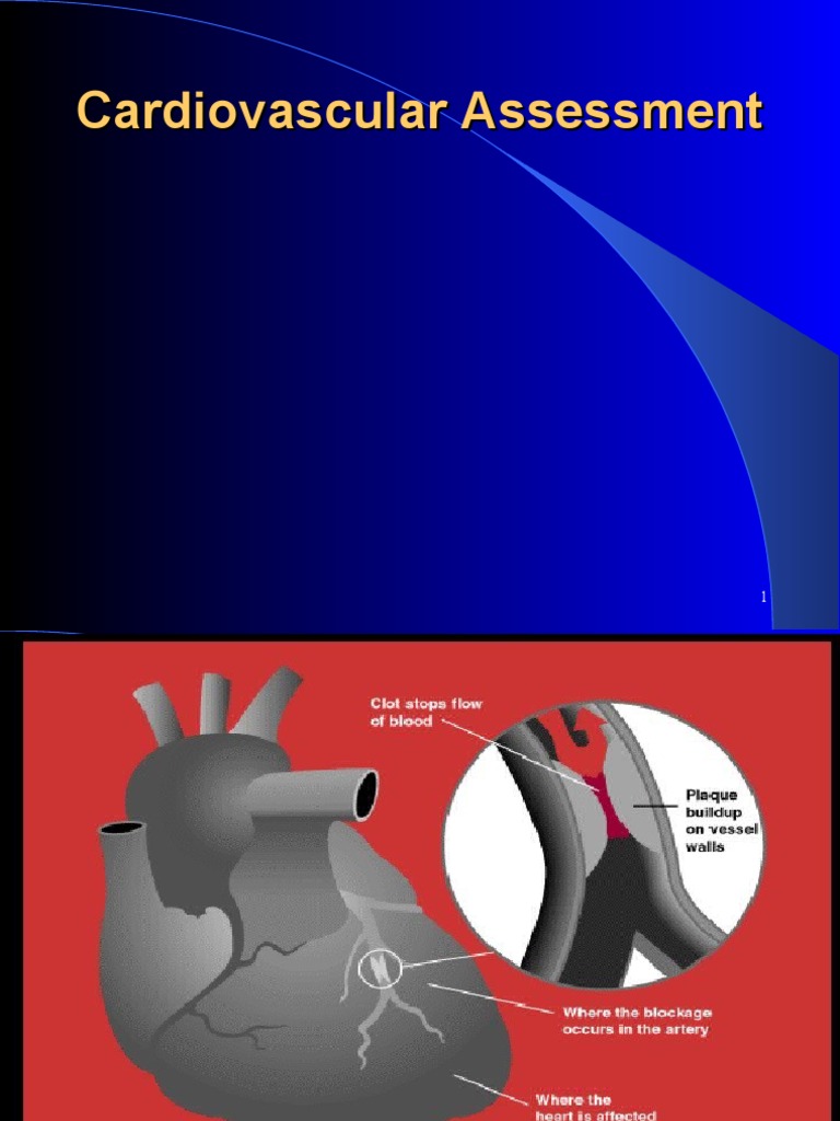 Understanding Ischemic Heart Disease | PDF | Atrium (Heart) | Heart