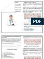 Cómo Leer e Informar Un Electrocardiograma