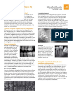 Xrays Spanish