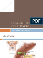 Colecistitis y Colelitiasis
