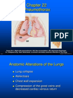 pneumothorax case study scribd