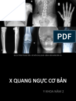 XQ NGUC CO BAN