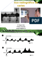 2 diagnóstico radiográfico de caries uach para imprimir