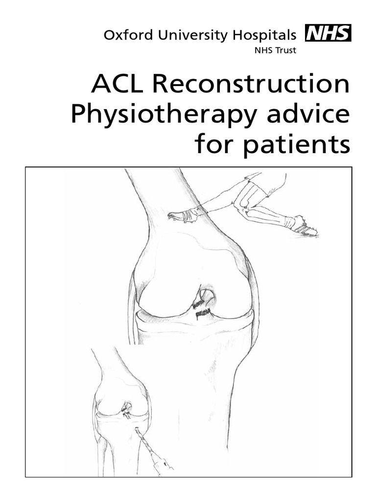 ACL Reconstruction Physiotherapy Guide | PDF | Knee | Dance Science