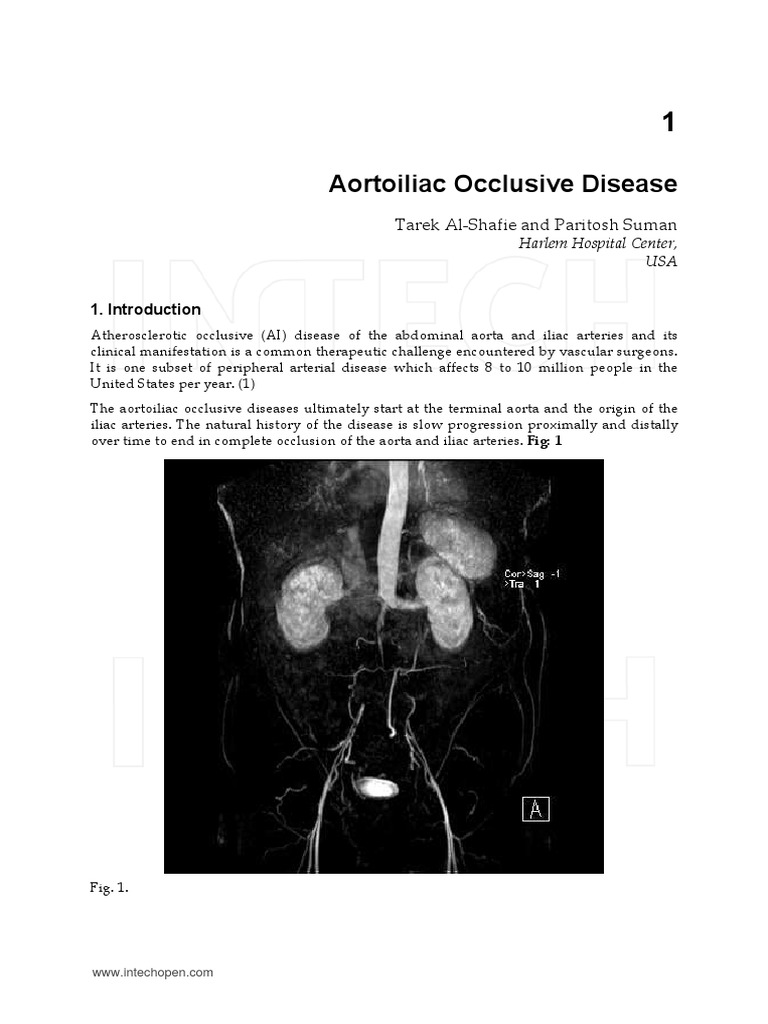 Aortoiliac Occlusive Disease | PDF | Angiography | Ischemia