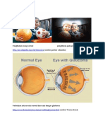 Penglihatan Orang Normalpenglihatan Pada Penderita Glaukoma