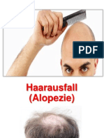 Kreisrunder Haarausfall (Alopecia Areata) - Alopecia Areata Behandlung