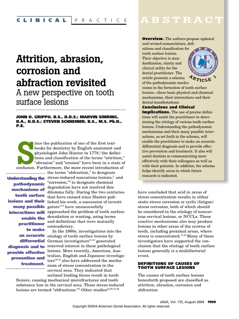 Attrition Abrasion Corrosion and Abfraction Revisited Tooth Enamel