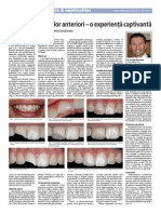 Restaurarea Dintilor Anteriori