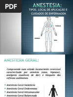 Tipos de Anestesias