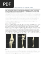 O que você deveria saber sobre seu joelho.docx