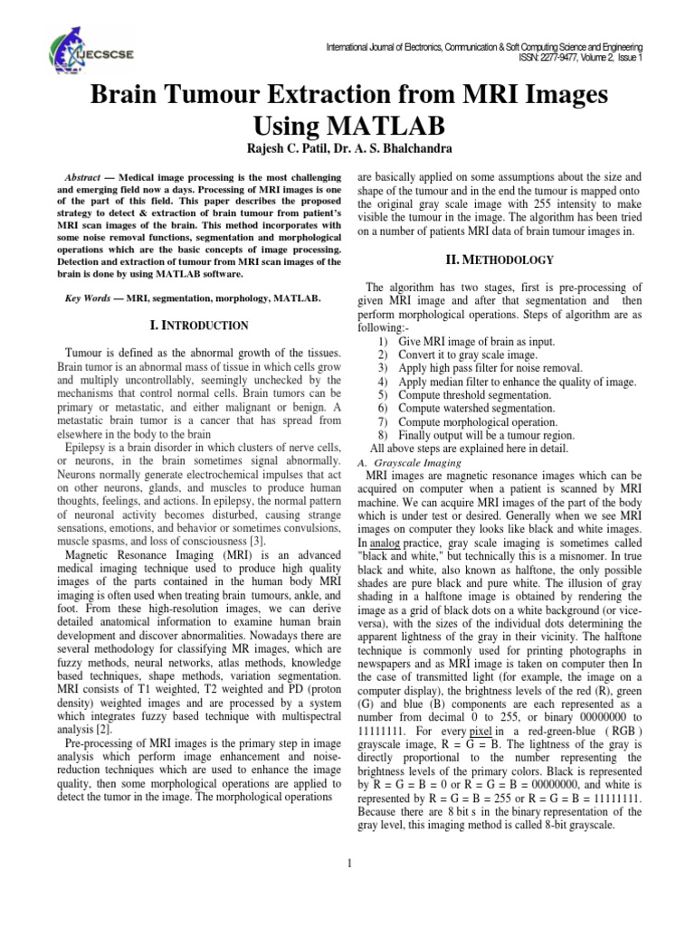 Brain Tumour Extraction From MRI Images Using MATLAB | PDF | Image ...