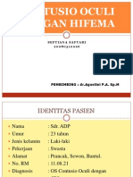 Presentasi Kasus - Contusio Oculi Dengan Hifema