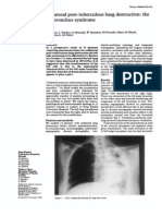 Left Bronchus Syndromec