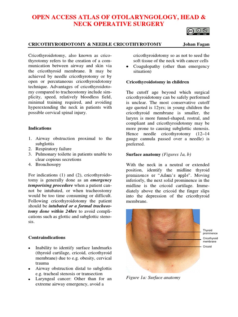 Cricothyroidotomy and Needle Cricothyrotomy | Respiratory Tract ...