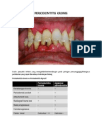 Periodontitis Kronis (Ummah)