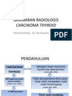 Gambaran Radiologis Carcinoma Thyroid