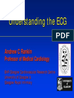 Understanding the ECG