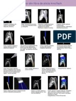 Protocol de Cimentare Pivoti A4