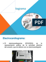 Electrocardiogram A