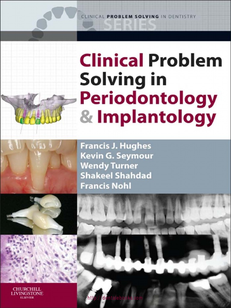 Clinical Problem Solving In Periodontology And Implantology - 