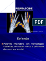Aula- Artrite Reumatoide