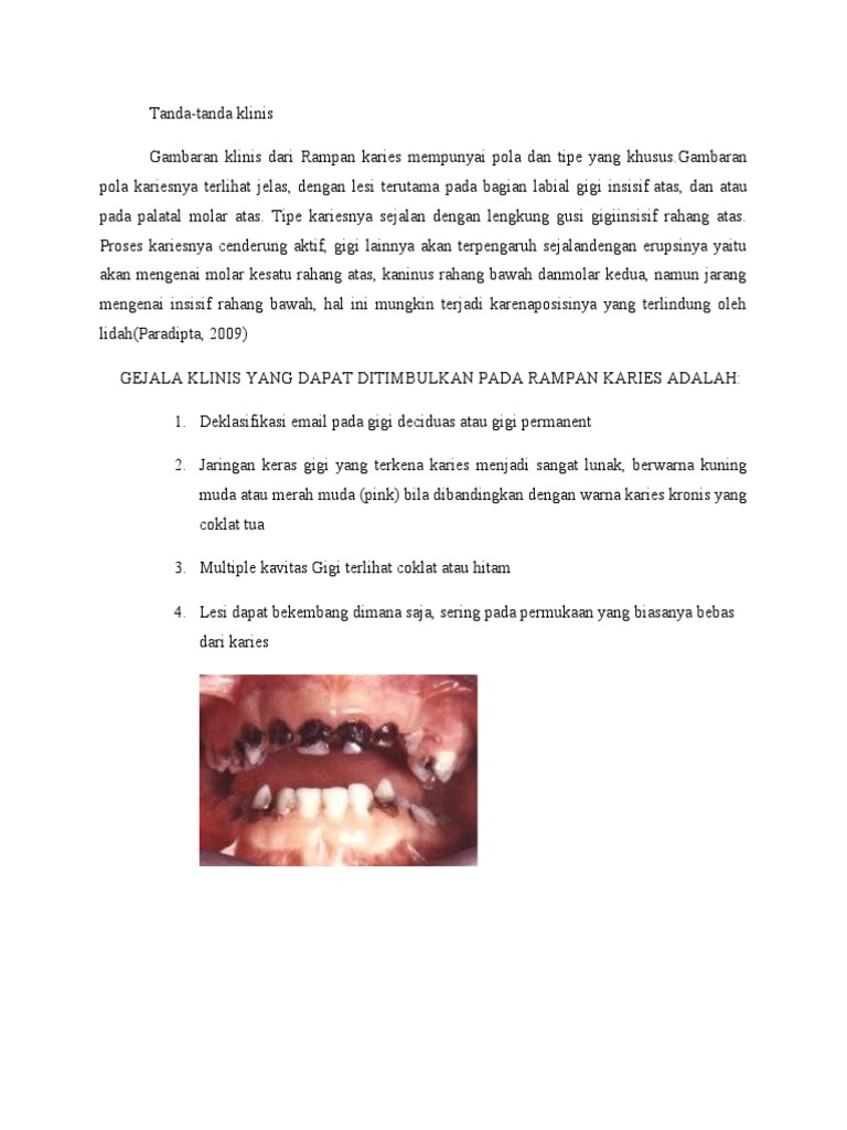 Rampan Karies | PDF