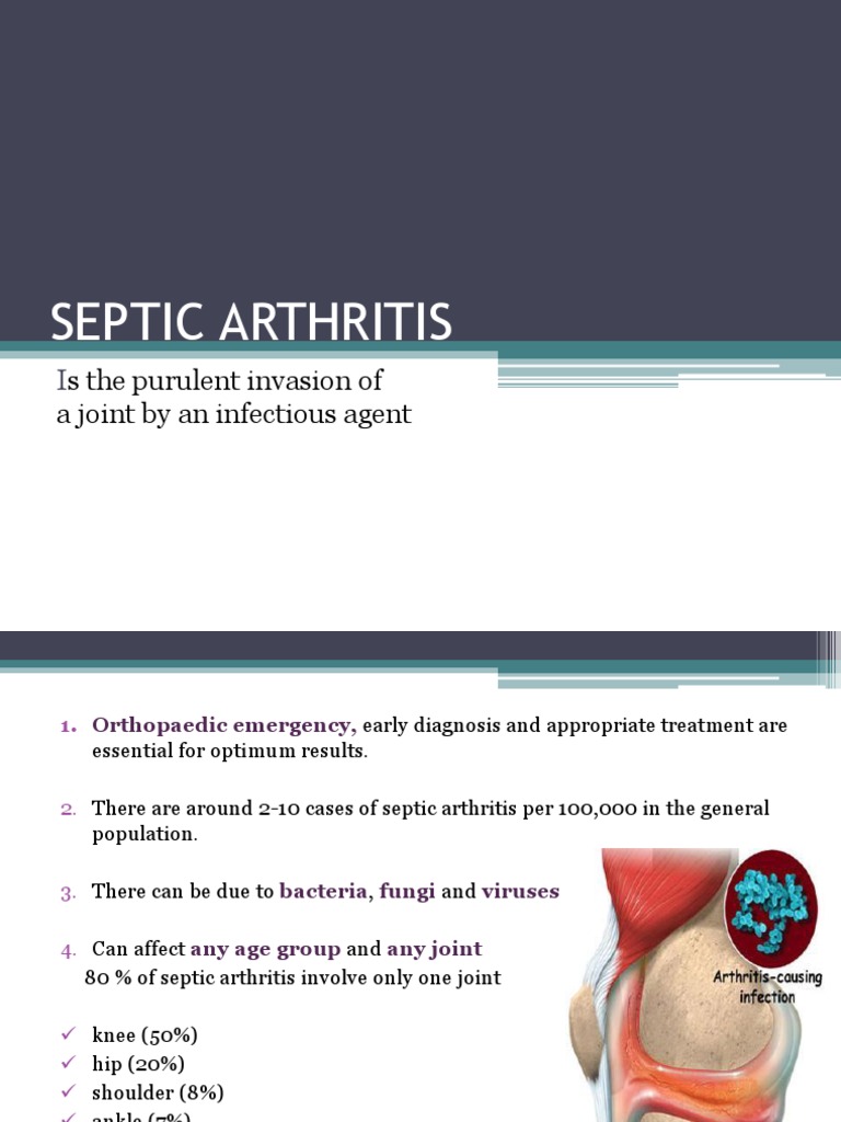 Septic Arthritis Medical Specialties Clinical Medicine