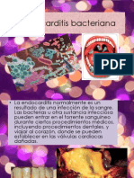 Endocarditis Bacteriana