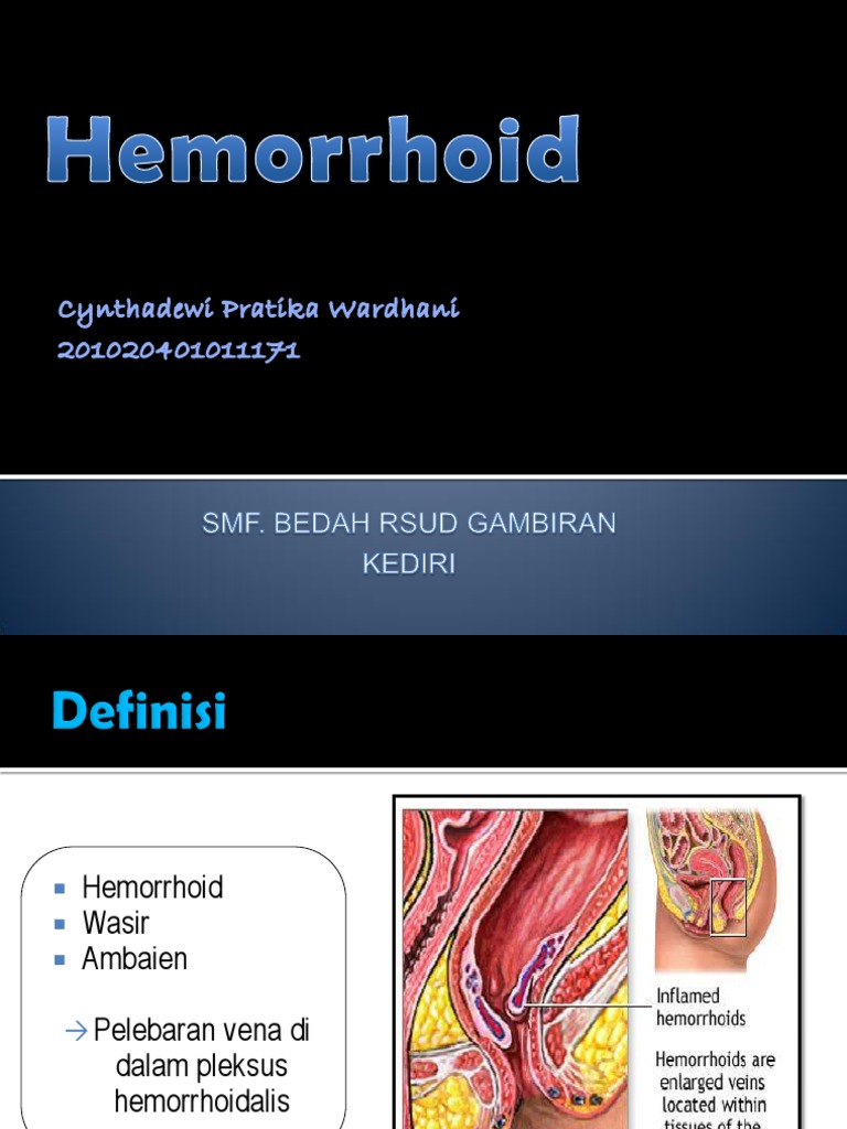 Hemorrhoid PDF