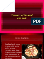 Tumours of The Head and Neck