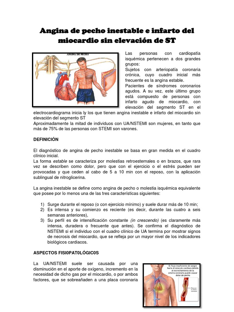 Angina de Pecho Inestable e Infarto Del Miocardio Sin Elevación de ST ...