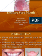 Denture Sore Mouth