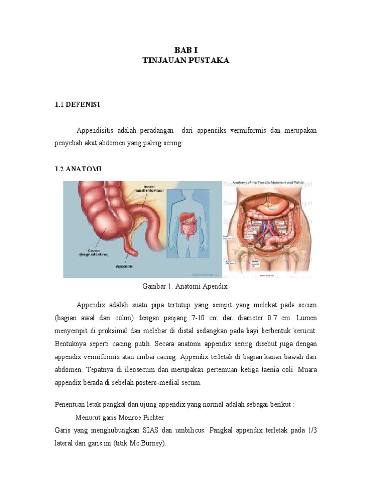 Apendisitis Akut Refrat Pdf