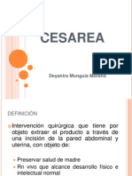 Cesarea