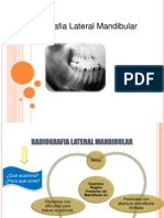 RadiografIa Lateral MandibulaR