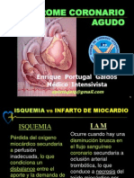 Curso ECG - 6 Infarto Agudo de Miocardio