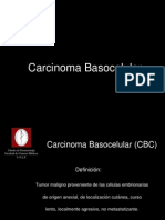 14 Carcinoma Basocelular