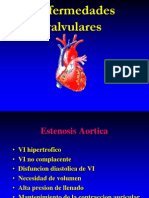 Valvulopatias