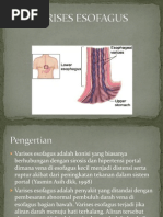 Download VARISES ESOFAGUS by Rafil Hanafi SN217372107 doc pdf