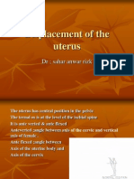 Displacement of The Uterus: DR Sahar Anwar Rizk
