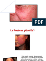 Tratamiento Natural Para La Rosacea - Rosacea Piel, Cura Rosacea, Piel Rosacea Como Curar